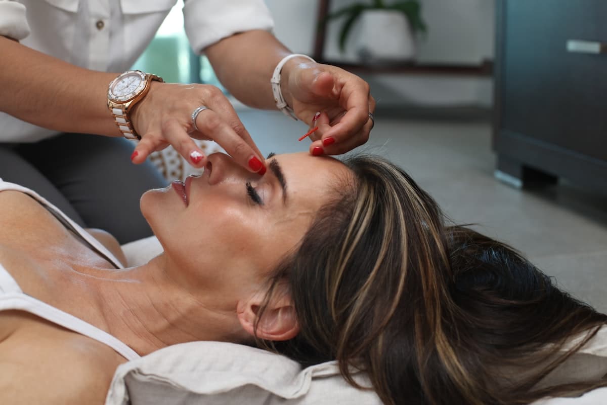 Facial rejuvenation acupuncture in session